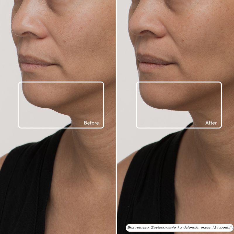 Maska LED do twarzy Therabody TheraFace Mask Led 9