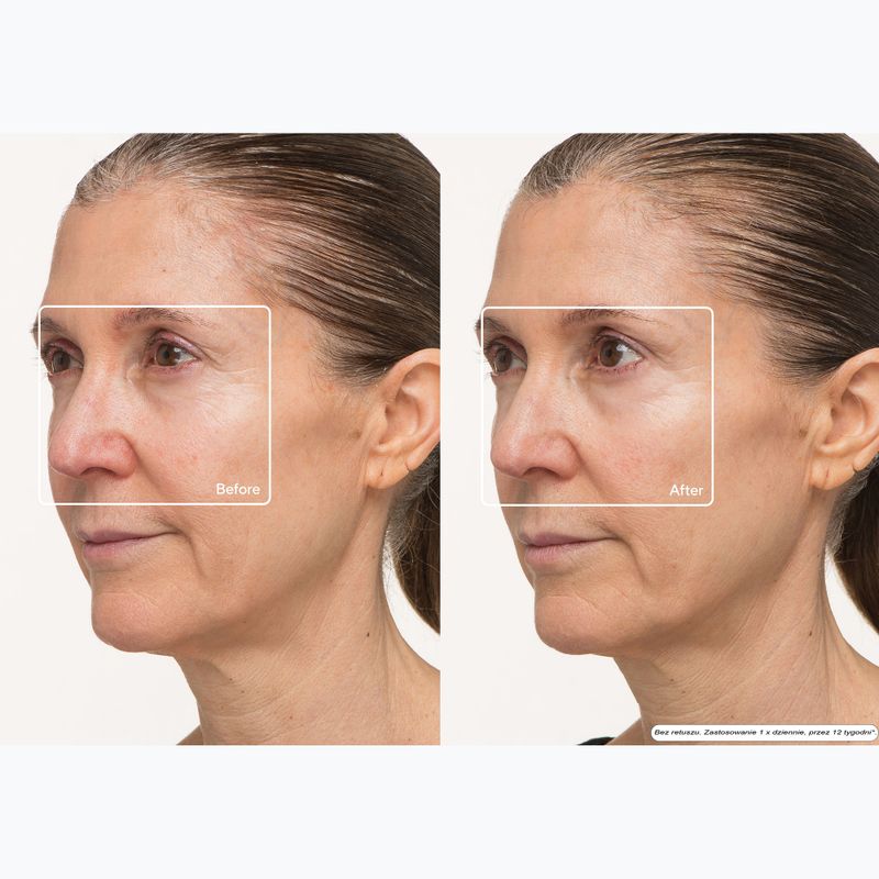 Maska LED do twarzy Therabody TheraFace Mask Led 10