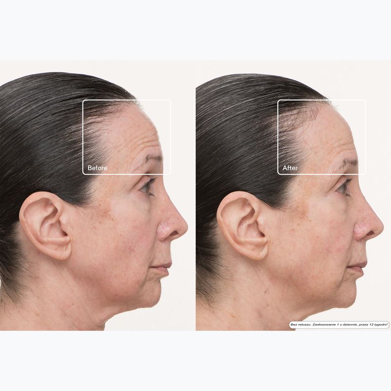 Maska LED do twarzy Therabody TheraFace Mask Led 11