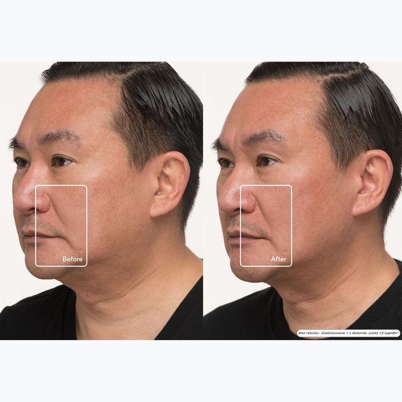 Maska LED do twarzy Therabody TheraFace Mask Led 12